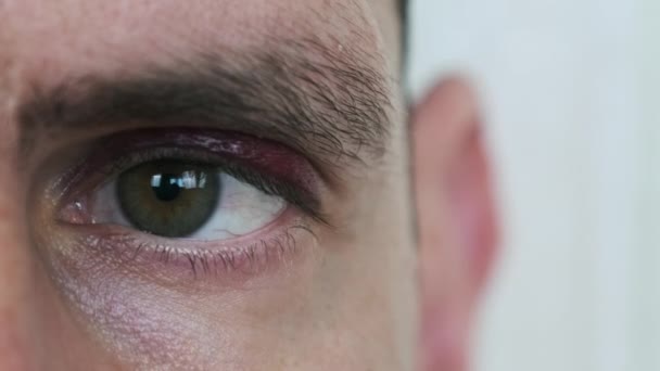 Bruise Eye Man Close Young Male Face Black Eye Portrait — Wideo stockowe