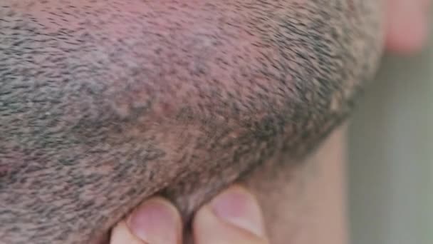 Male Bristle Close Anak Muda Menyentuh Dengan Tangan Kerikil Wajah — Stok Video