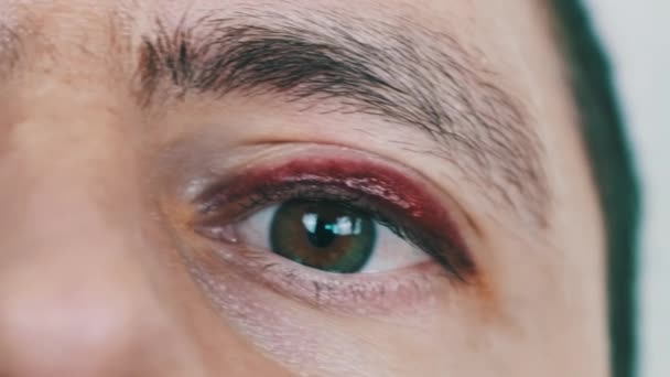 Riktig Blåtira Det Unga Manliga Ansiktet Ett Blåmärke Mans Ögonlock — Stockvideo
