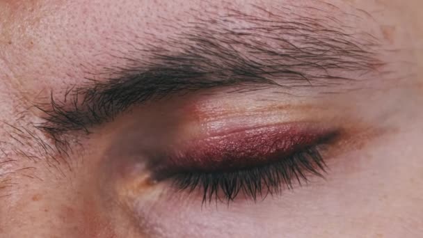 一个真正的黑眼圈在年轻的男性脸上 一个男人眼睑上的瘀伤 在眼睑上有血肿的人物形象遭到殴打 眼睛在宏观上眨了眨眼 看着相机 — 图库视频影像