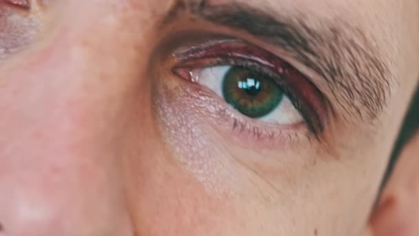 Moretones Ojo Hombre Cerca Cara Masculina Joven Con Ojo Morado — Vídeos de Stock