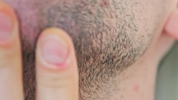 Male Bristle Close Young Man Touching Hand Stubble Face Rubs — Video