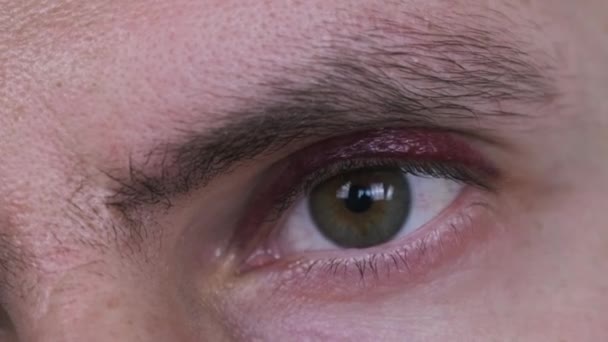 Bruise Eye Man Close Young Male Face Black Eye Portrait — стокове відео