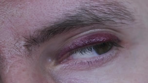 一个真正的黑眼圈在年轻的男性脸上 一个男人眼睑上的瘀伤 在眼睑上有血肿的人物形象遭到殴打 眼睛在宏观上眨了眨眼 看着相机 — 图库视频影像