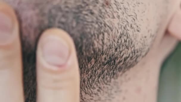 Male Bristle Close Young Man Touching Hand Stubble Face Rubs — Video