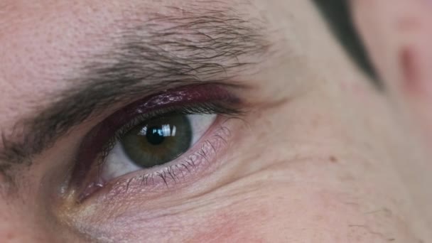 擦伤了一个男人的眼睛 有黑眼圈的年轻男性脸 在眼睑上有真正血肿的人物形象被击败了 眼睛在宏观上眨了眨眼 看着相机 面部创伤4K — 图库视频影像