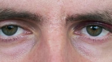 Bir adamın gözündeki çürük, yakın plan. Gözü morarmış genç bir erkek yüzü. Göz kapağında gerçek bir hematom olan dövülmüş bir adam portresi. Göz makroda yanıp sönüyor ve kameraya bakıyor. Fingal, yüz travması 4K