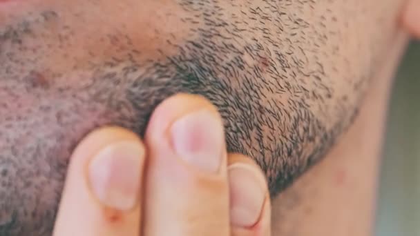男性刚毛特写 年轻人用手触摸着脸上的残茬 用手指擦拭下巴 未剃光的男性胡子 有黑色的毛 头发在人的皮肤上 有毛发生长的脖子和胡子 — 图库视频影像