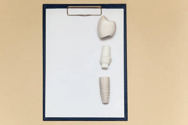 Impianto Dentale Cartella Con Clip Fogli Carta Sfondo Beige Modello — Foto Stock