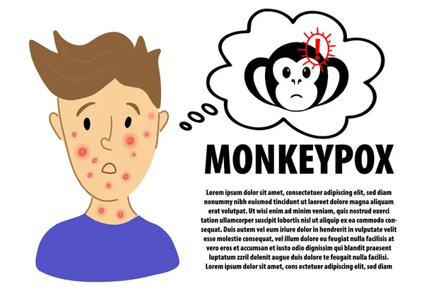 Maymun çiçeği infografik pankart tasarımı. Maymun Çiçeği virüsünden muzdarip bir erkek. Maymun Çiçeği virüsü tehlike simgesi uyarısı. Yüzünde kızarıklık olan düz karakter portresi - çiçek hastalığının belirtileri.