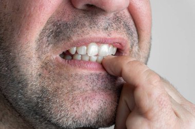 Kafkasyalı bir adam, dişlerini yakın çekimde tırnak yiyor.