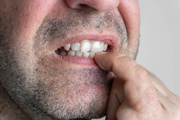 Λευκός Άντρας Κοντινό Πλάνο Νύχια Που Δαγκώνουν Δόντια — Φωτογραφία Αρχείου
