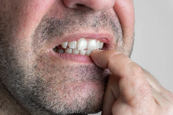 Homme Caucasien Gros Plan Des Dents Mordant Les Ongles — Photo