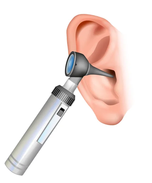 Осмотр ушей. Обследование наружного слухового канала для исследования барабанной перепонки. Реалистичная иллюстрация инструментов ЛОР-специалиста: отоскоп и ухо. — стоковый вектор