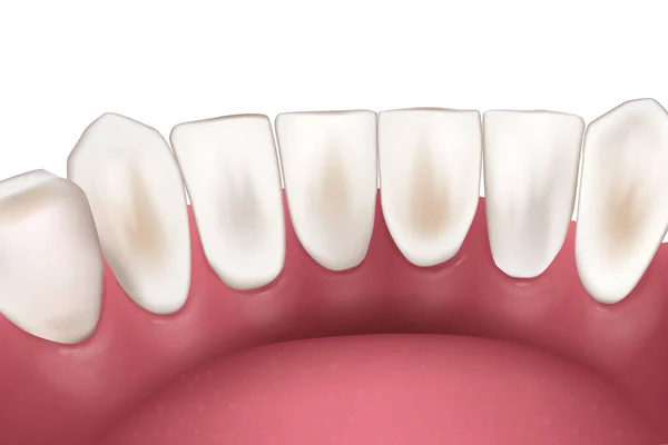 Реалістичні Зуби Нижніх Різців Візуалізація Нижньої Щелепи Стоматологічна Анатомія Медично — стоковий вектор