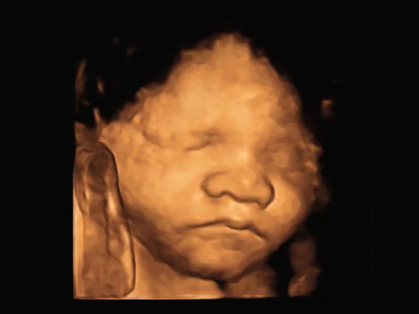 Gambar Ultrasound Bayi Dalam Rahim Ibu Stok Lukisan  