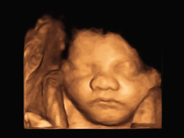Image Ultrasound Baby Mother Womb lizenzfreie Stockbilder