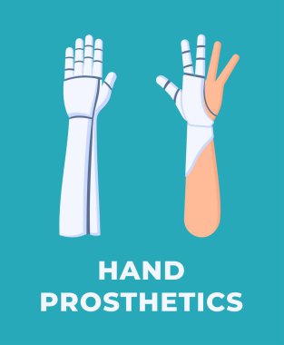 Mavi arka planda izole edilmiş bir el protezinin vektör çizimi. Bir insan için protez kol. Modellik. Üretim. Sağlık sorunları olan insanlara yardım. El..