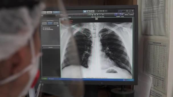 Γιατρός Εξετάζει Την Ακτινογραφία Θώρακα Στην Οθόνη Του Υπολογιστή Στο — Αρχείο Βίντεο