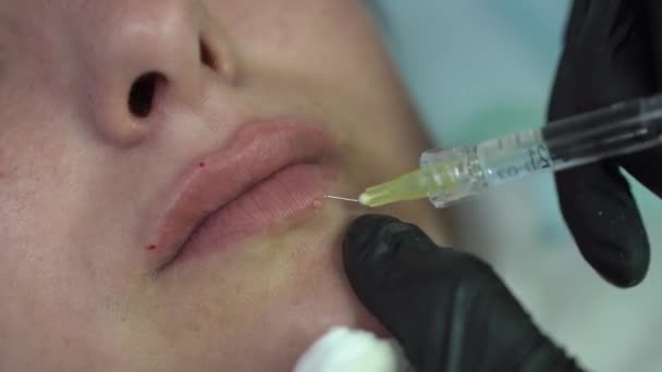 Wanita Menjalani Prosedur Pelepasan Bibir Master Layanan Kosmetik Membuat Injeksi — Stok Video