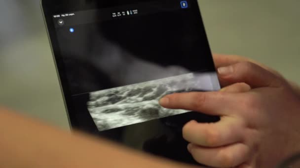 Doctor Makes Ultrasound Examination Portable Scanner Patient Diagnosing — 图库视频影像