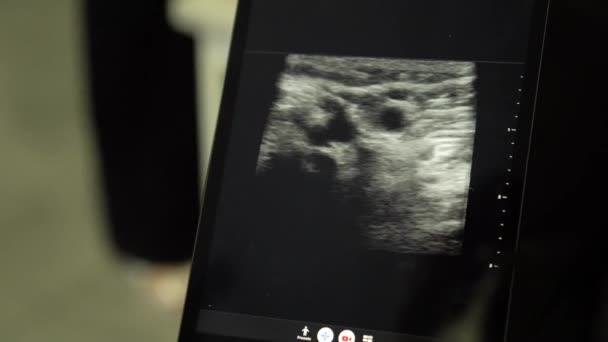 Sonography Human Ultrasound Scan Diagnostic Center — ストック動画