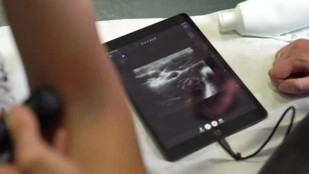 Läkaren Gör Ultraljudsundersökning Mans Arm Ett Sjukhus Som Gör Hälsodiagnostik — Stockvideo
