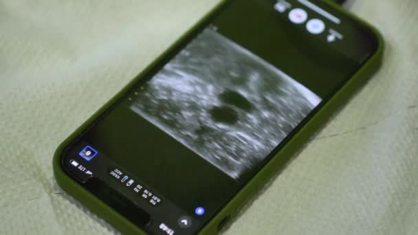 Läkare Kirurger Titta Ultraljudsresultatet Röntgenbilden Tabletten Datordiagnostik Sonogram — Stockvideo