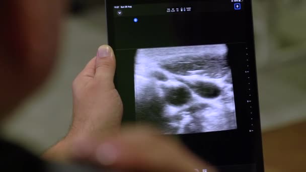 Médico Diagnostica Hombre Cuello Con Escáner Ultrasonido Hace Procedimiento Rayos — Vídeo de stock