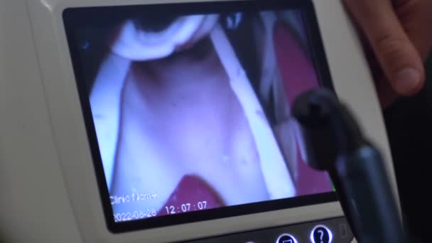 研修生は マネキンに最新のビデオ喉頭鏡で気管挿管を行います 喉頭器官の手術 気管支の病院での練習 — ストック動画