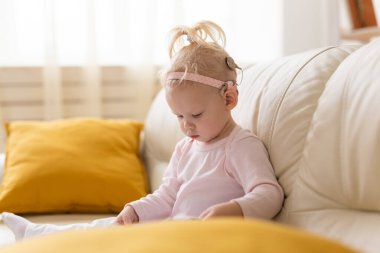 Baby with cochlear implants at home. Deafness and medical technology concept.