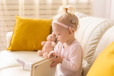 Baby with cochlear implants at home. Deafness and medical technology and diversity concept.