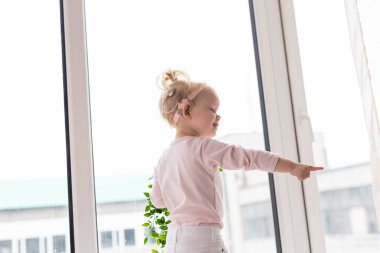 Baby with cochlear implants at home. Deafness and medical technology concept.