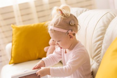 Cochlear implant for baby. Deaf child with hearing aid. Health care and medicine technology and innovations and diversity