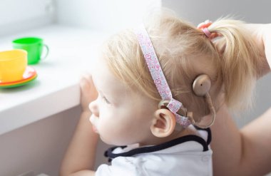 Anne kızının koklear implant işitme cihazını tamir ediyor. Sağırlık ve çeşitlilik kavramı. Tedavi sağırlığında yenilikçi teknolojiler