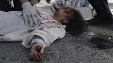 Ambulans ekibi yolda yaralanan çocuk için ilk yardım sağlıyor.