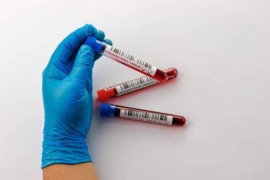 maymun çiçeği virüsü için kan testi yapılan mataralar pozitif ve negatif.