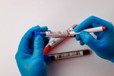maymun çiçeği virüsü için kan testi yapılan mataralar pozitif ve negatif.