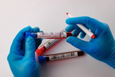 maymun çiçeği virüsü için kan testi yapılan mataralar pozitif ve negatif.