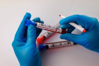 maymun çiçeği virüsü için kan testi yapılan mataralar pozitif ve negatif.