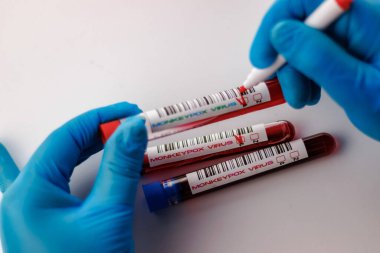 maymun çiçeği virüsü için kan testi yapılan mataralar pozitif ve negatif.