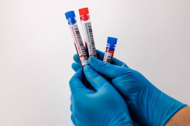 maymun çiçeği virüsü için kan testi yapılan mataralar pozitif ve negatif.