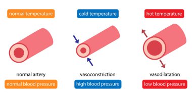 cooling cause vasoconstriction and increase blood pressure. heat cause vsasodilation and decrease blood pressure. Health care concept  clipart