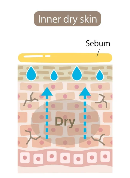 Inner Dry Skin Cell Layer Skin Produce Extra Sebum Moisturize — Stock Vector