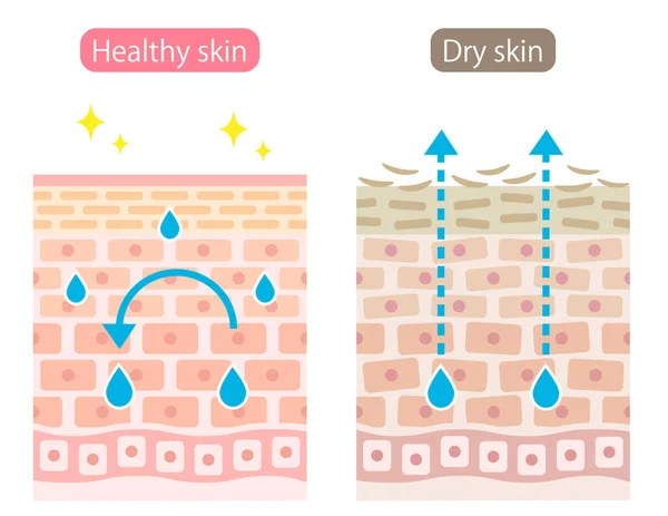 Illustrazione Asciutta Sana Dello Strato Cellulare Della Pelle Evaporazione Umidità — Vettoriale Stock