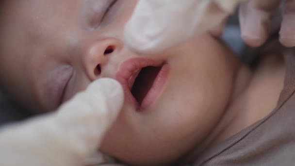 Doktorlar uyumakta olan bebeğe bakıyorlar. Diş macununda ilk süt dişleri çıkıyor. — Stok video