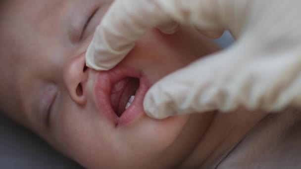 Orvosok kéz ellenőrzi alvó csecsemő első tej fogzás íny fogíny — Stock videók