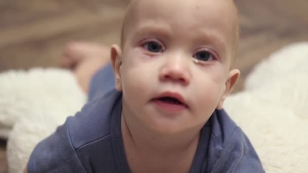 Primo piano bambino congiuntivite oculare rosa su infezione caucasica del viso del bambino — Video Stock