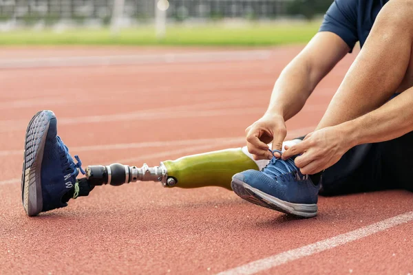 Fechar o homem com deficiência atleta com prótese de perna . — Fotografia de Stock