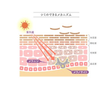 Illustration showing the mechanism of stains.Japanese notation. clipart